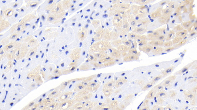 ACVR2A Antibody in Immunohistochemistry (Paraffin) (IHC (P))