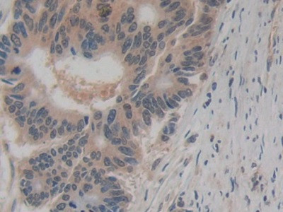 Amphiregulin Antibody in Immunohistochemistry (Paraffin) (IHC (P))