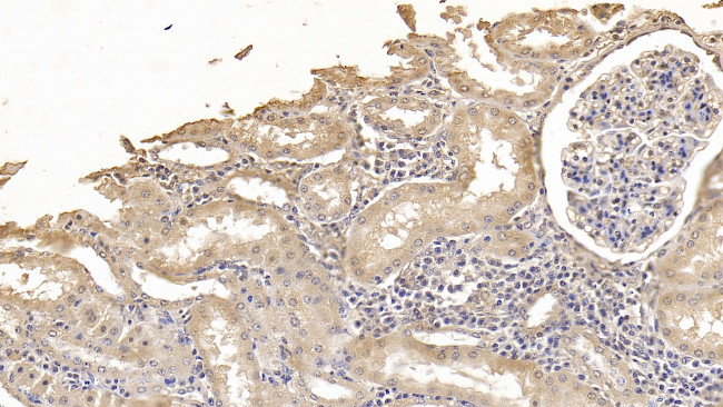 Antithrombin Antibody in Immunohistochemistry (Paraffin) (IHC (P))