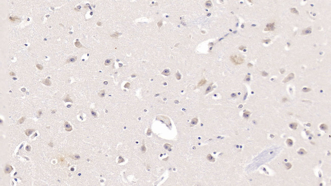 APOL2 Antibody in Immunohistochemistry (Paraffin) (IHC (P))