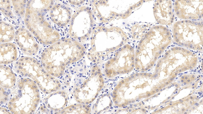 Arginase 2 Antibody in Immunohistochemistry (Paraffin) (IHC (P))