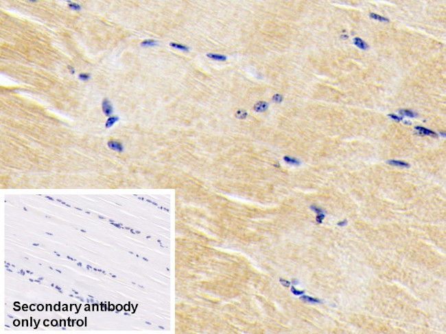 BMP3 Antibody in Immunohistochemistry (Paraffin) (IHC (P))