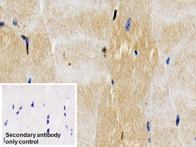 Caspase 6 Antibody in Immunohistochemistry (Paraffin) (IHC (P))