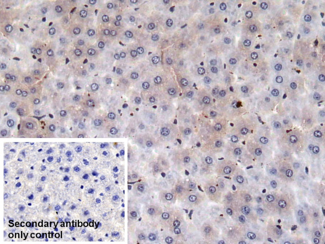 Prothrombin Antibody in Immunohistochemistry (Paraffin) (IHC (P))
