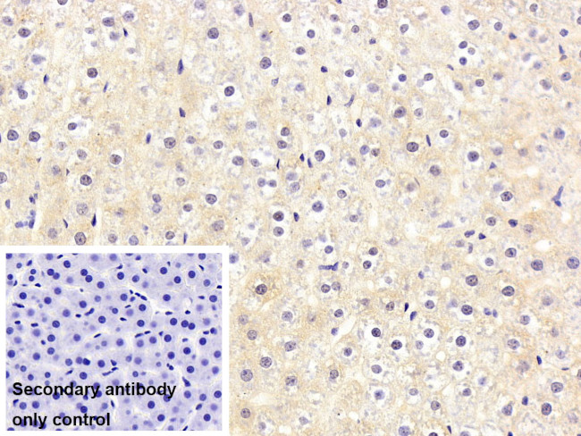 Prothrombin Antibody in Immunohistochemistry (Paraffin) (IHC (P))
