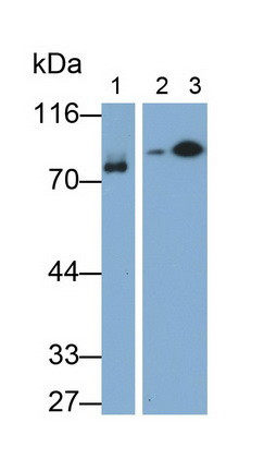 C1 inhibitor Antibody in Western Blot (WB)