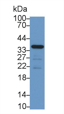 CRHBP Antibody in Western Blot (WB)
