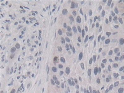 Cyclophilin A Antibody in Immunohistochemistry (Paraffin) (IHC (P))