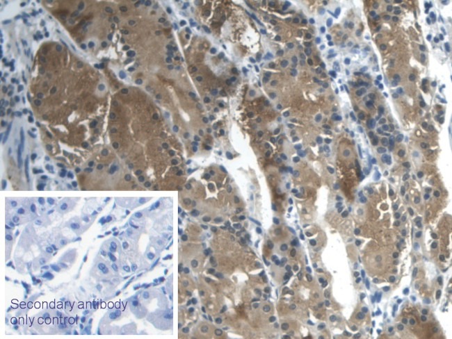 Galectin 2 Antibody in Immunohistochemistry (Paraffin) (IHC (P))