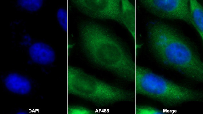HSP20 Antibody in Immunocytochemistry (ICC/IF)