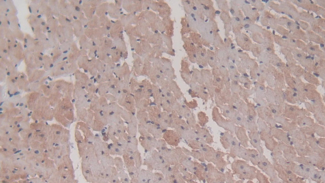 HSP20 Antibody in Immunohistochemistry (Paraffin) (IHC (P))