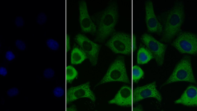 IGF1 Antibody in Immunocytochemistry (ICC/IF)