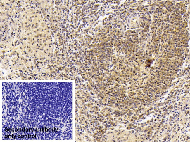 IGFBP-1 Antibody in Immunohistochemistry (Paraffin) (IHC (P))
