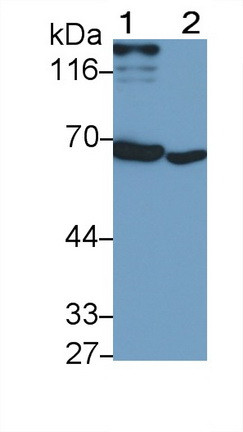 IFNAR1 Antibody in Western Blot (WB)