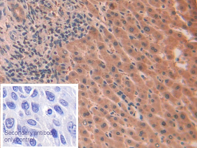 IL-1 alpha Antibody in Immunohistochemistry (Paraffin) (IHC (P))