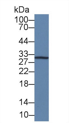 IL-12 p35 Antibody in Western Blot (WB)
