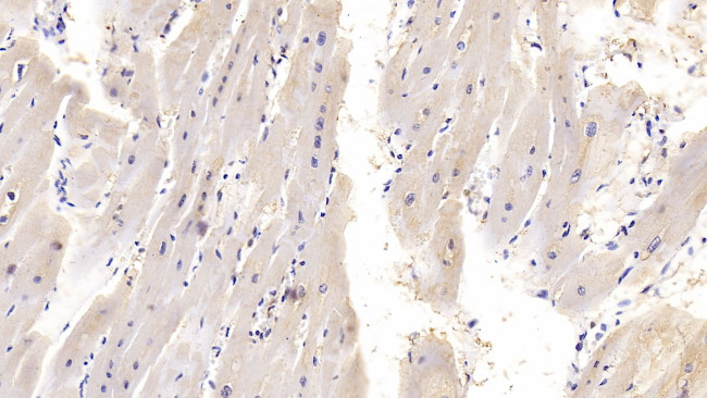 IL-18 Antibody in Immunohistochemistry (Paraffin) (IHC (P))