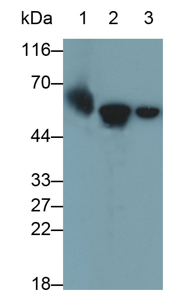 Cytokeratin 6A Antibody in Western Blot (WB)