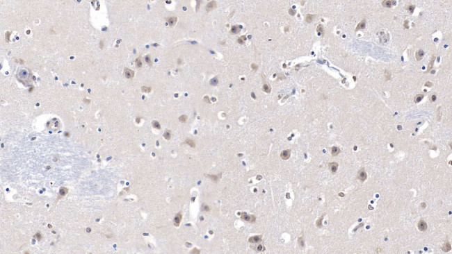 LCAT Antibody in Immunohistochemistry (Paraffin) (IHC (P))