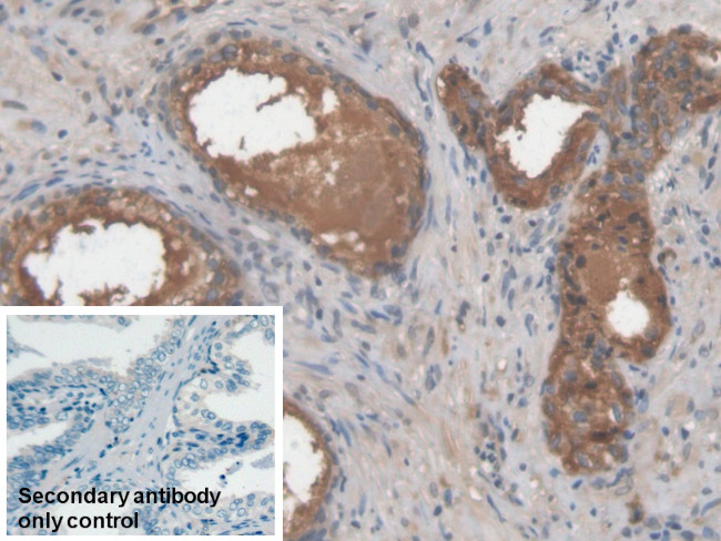 LGALS3BP Antibody in Immunohistochemistry (Paraffin) (IHC (P))