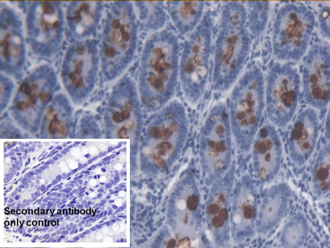 LPS Antibody in Immunohistochemistry (Paraffin) (IHC (P))