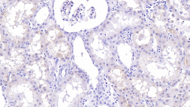 LUM Antibody in Immunohistochemistry (Paraffin) (IHC (P))