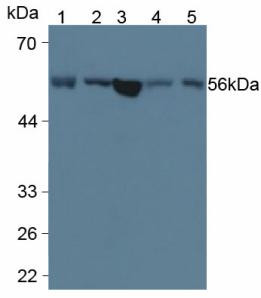 LPCAT3 Antibody in Western Blot (WB)