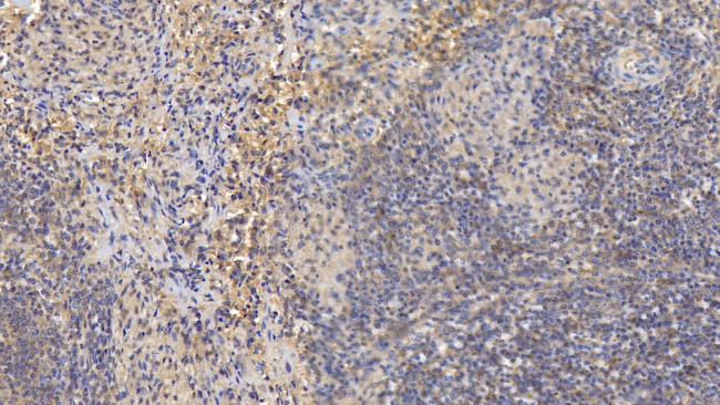 MMP8 Antibody in Immunohistochemistry (Paraffin) (IHC (P))