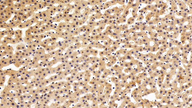 MX1 Antibody in Immunohistochemistry (Paraffin) (IHC (P))