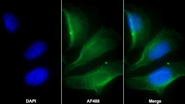 Nephrin Antibody in Immunocytochemistry (ICC/IF)