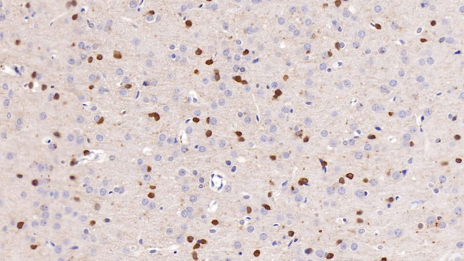 NGAL Antibody in Immunohistochemistry (Paraffin) (IHC (P))