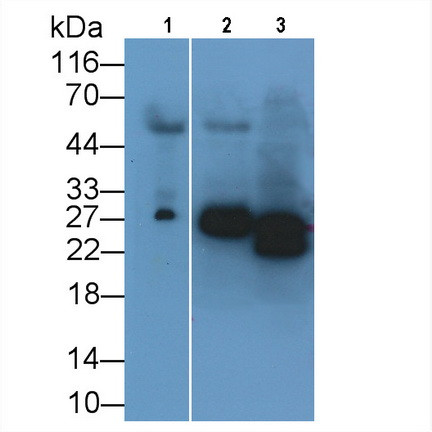 NGAL Antibody in Western Blot (WB)