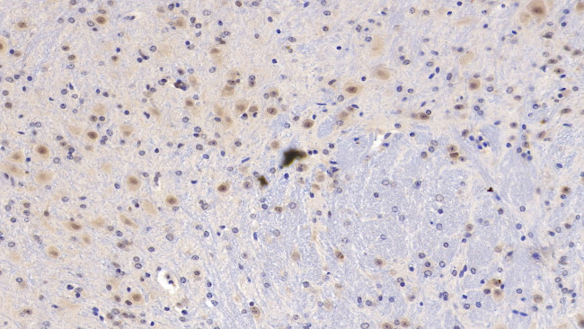 PEDF Antibody in Immunohistochemistry (Paraffin) (IHC (P))
