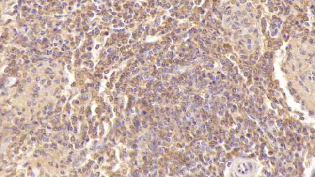 PF4 Antibody in Immunohistochemistry (Paraffin) (IHC (P))