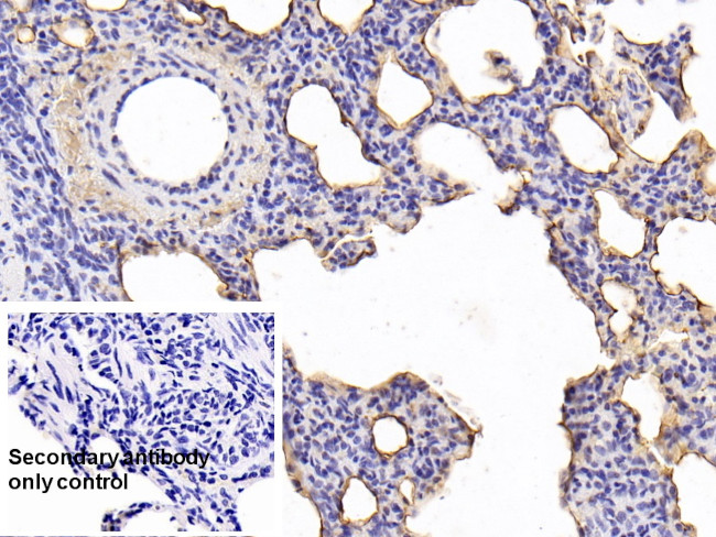 SFTPA1 Antibody in Immunohistochemistry (Paraffin) (IHC (P))
