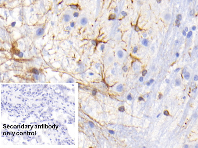 RBP2 Antibody in Immunohistochemistry (Paraffin) (IHC (P))