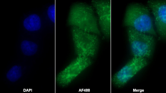 S100A8 Antibody in Immunocytochemistry (ICC/IF)
