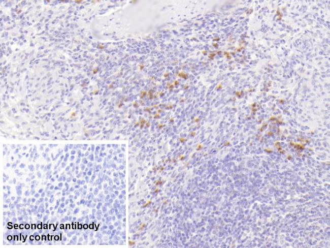 S100A9 Antibody in Immunohistochemistry (Paraffin) (IHC (P))