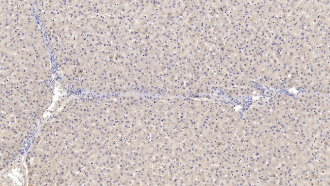 SERPINB4 Antibody in Immunohistochemistry (Paraffin) (IHC (P))