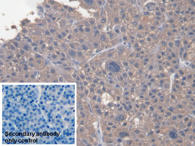 SAA Antibody in Immunohistochemistry (Paraffin) (IHC (P))
