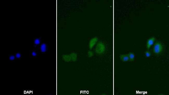 TK1 Antibody in Immunocytochemistry (ICC/IF)