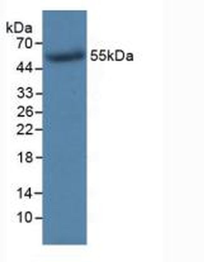 TK1 Antibody (MA5-41680)