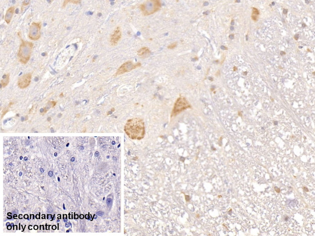 TFPI Antibody in Immunohistochemistry (Paraffin) (IHC (P))