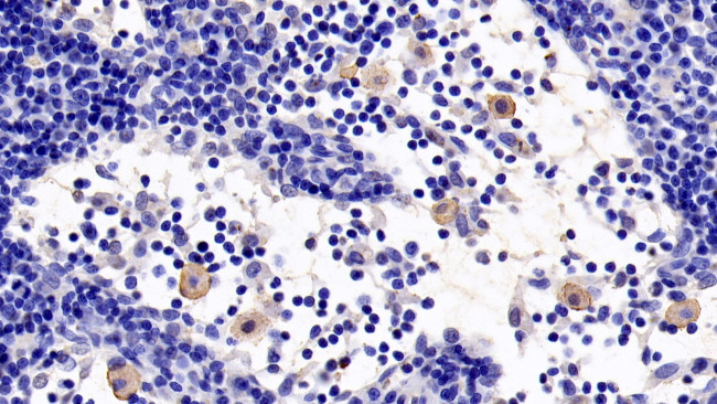 TLR5 Antibody in Immunohistochemistry (Paraffin) (IHC (P))