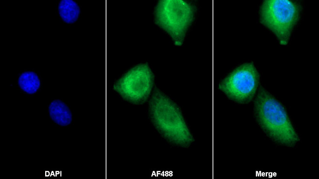 Cardiac Troponin I Antibody in Immunocytochemistry (ICC/IF)