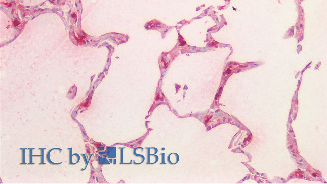 Tryptase Antibody in Immunohistochemistry (Paraffin) (IHC (P))