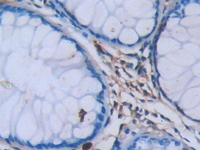 Tryptase Antibody in Immunohistochemistry (Paraffin) (IHC (P))