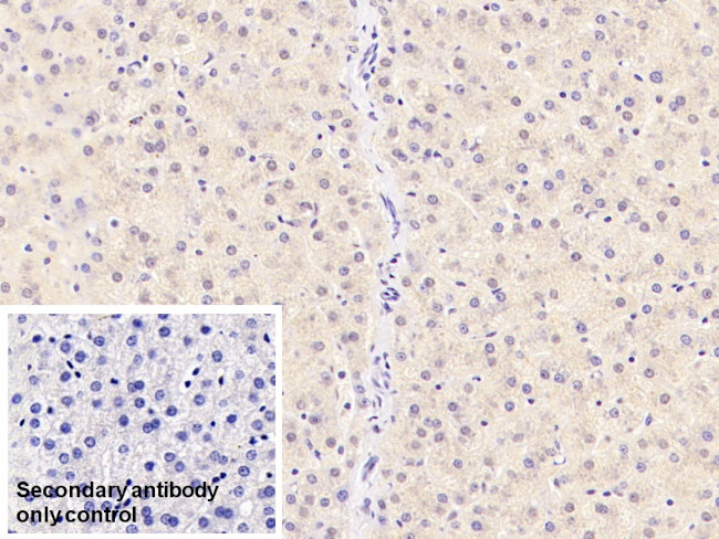 TDO2 Antibody in Immunohistochemistry (Paraffin) (IHC (P))