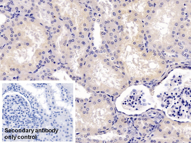 GC Antibody in Immunohistochemistry (Paraffin) (IHC (P))