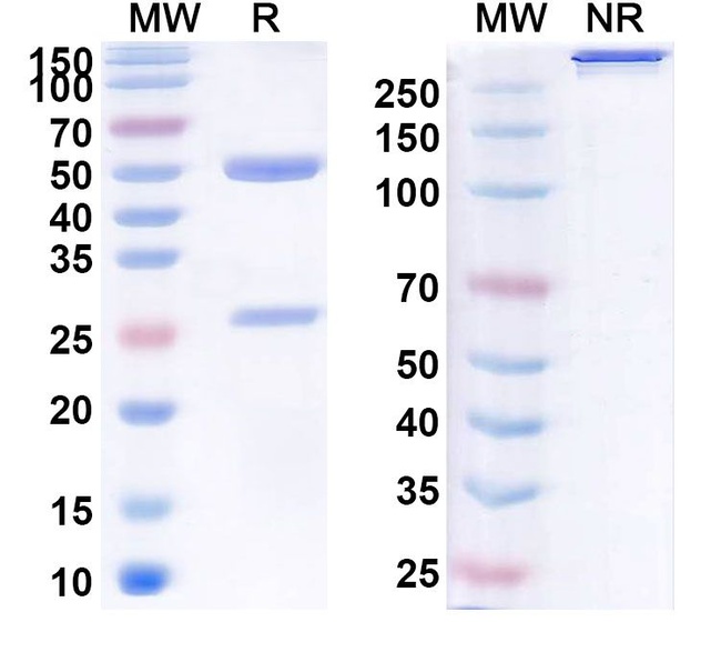Ruplizumab Humanized Antibody in SDS-PAGE (SDS-PAGE)